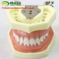 DENTAL04(12563) Anatomical Model Type Dental Study Models with Soft Gum